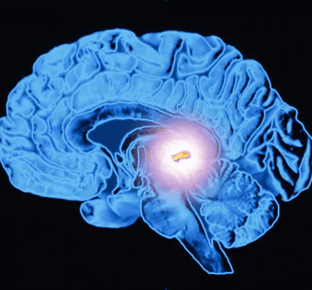 Placebo vs active routine illustration